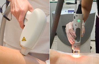 Що краще фотоепілятор або лазерний епілятор: порівняння приладів